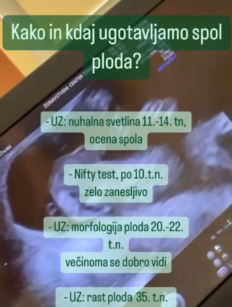 NIFTY in nuhalna svetlina za info o spolu ploda v ZC Dravlje